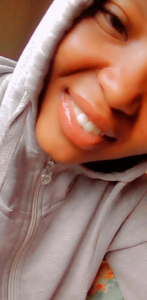 My little smile 🥺💋⭐✨✨✨