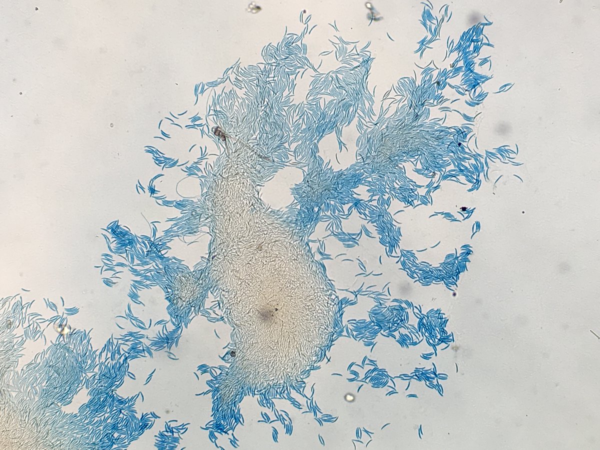 xmsunxhp's tweet photo. Colletotrichum siamense --a pathogen of keratitis https://t.co/LaPkaw1SKI
