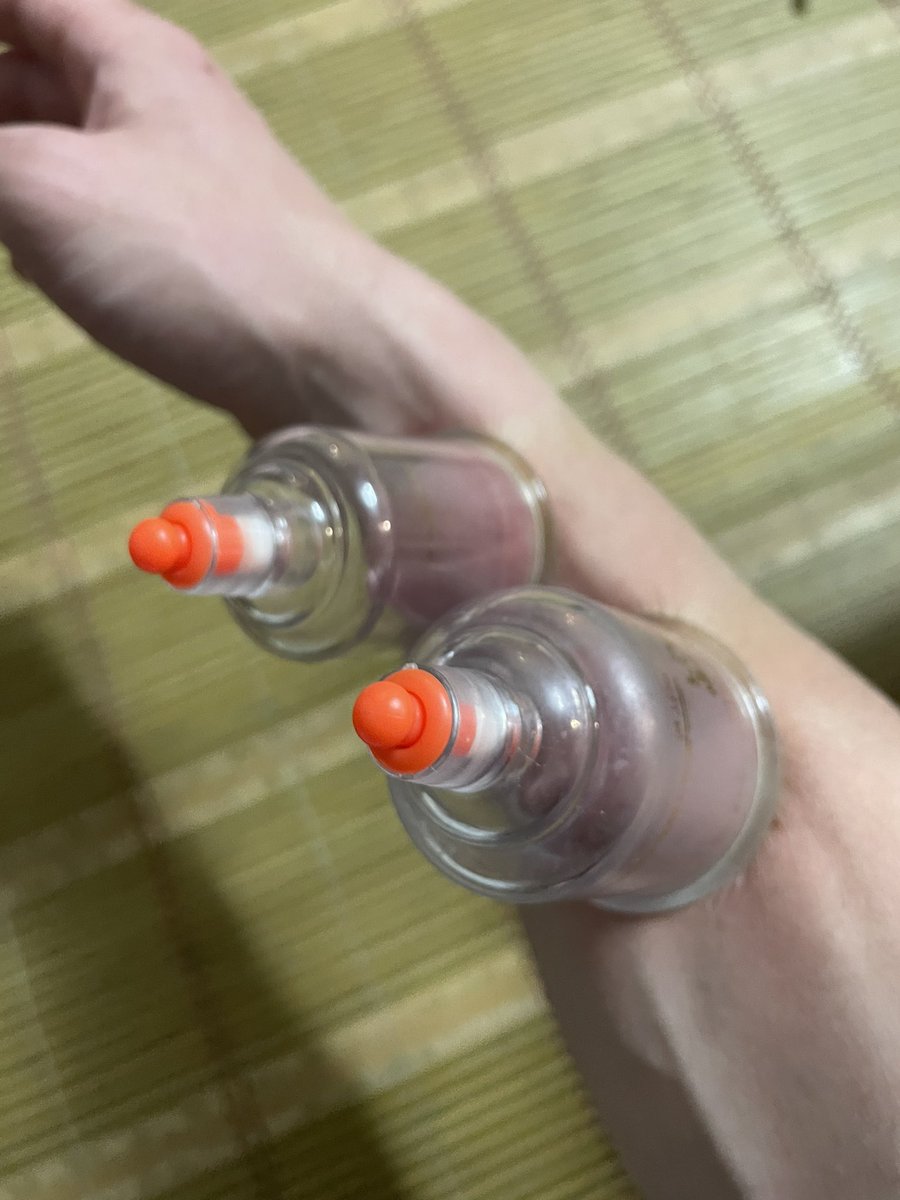 juniverseNFT's tweet image. Tryna release the tension in my thumbs and hands from scrolling on Twitter so damn much 🥲👍🏼📱 
#web3problems