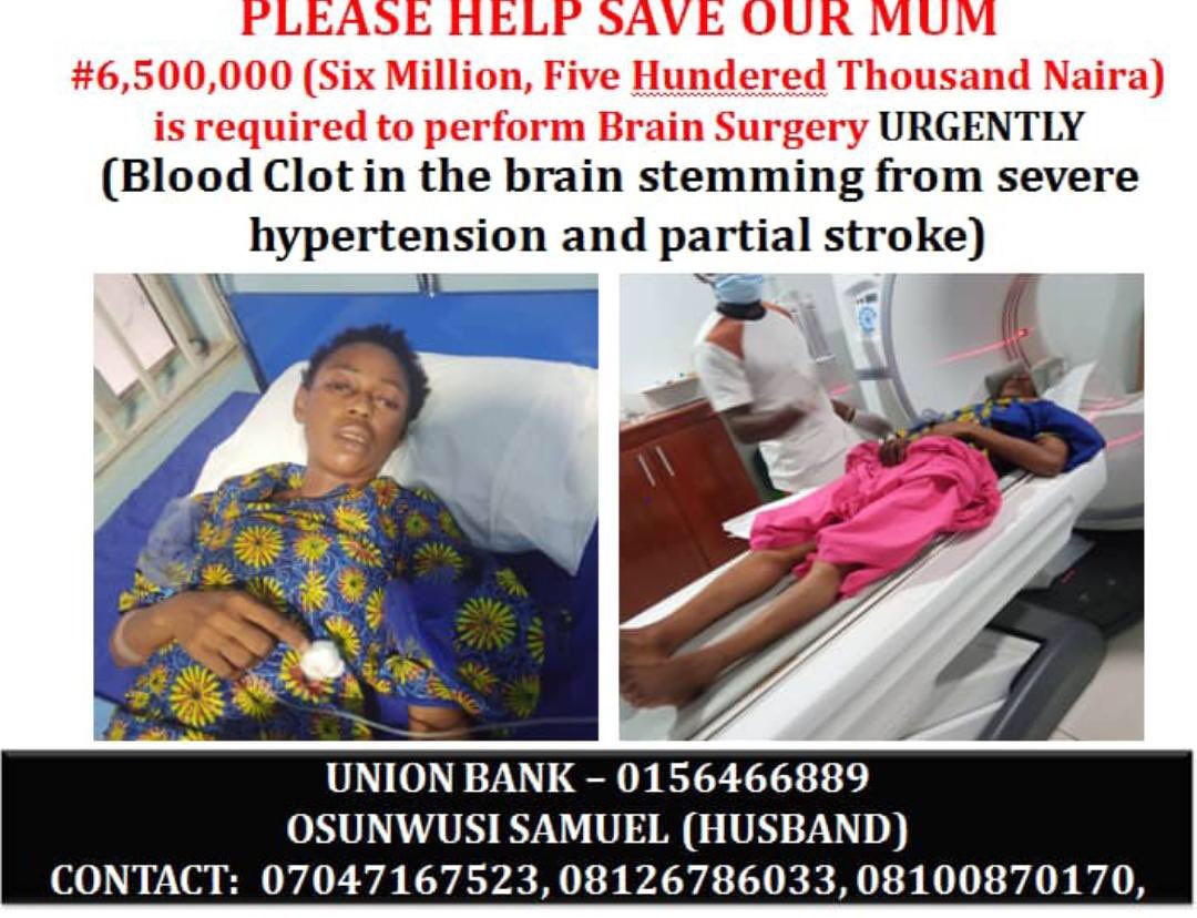@UnclePamilerin @chemicalbrodar @symplyDAPO @SeniormanOA @Obacruze @mrmacaronii @larmmy *PLEASE SAVE OUR MUM* We seek N6.5m for urgent surgery of Blood Clot in the brain. This is picture of how MUM look when she was diagnosed with Blood Clot in the brain stemming from