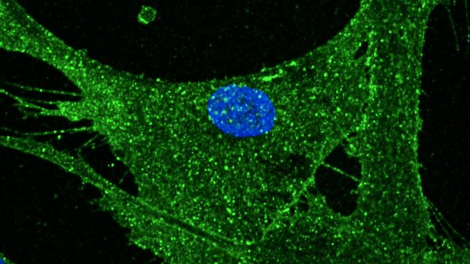 MozartCircle's tweet photo. #MozartCircleScience
8 April 2022@BabrahamInst, based on 2012
@NobelPrize #ShinyaYamanaka discovery on turning #NormalCells into #StemCells, managed to get the #Rejuvenation of 53yo Woman's skin into a 23yo Young Woman's skin!
#ff https://t.co/2ctvvy80OC
https://t.co/LBceWUp2T3 https://t.co/BqByBynD0U