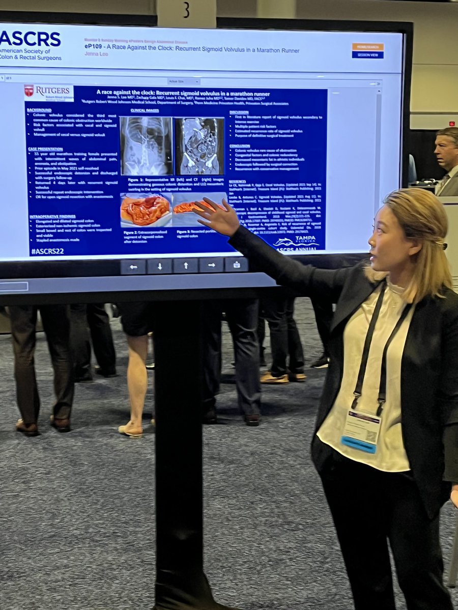 Recurrent sigmoid volvulus poster presentation done! Thank you to my @rwjsurgery family for the support! #ASCRS22