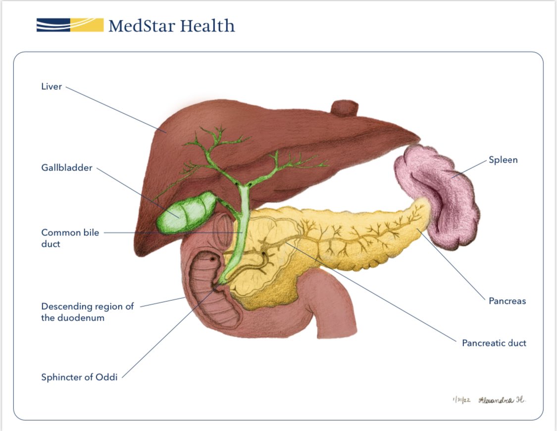 My teenage daughter illustrated this anatomy diagram for our HPB clinic and I use it with every patient 😊 #prouddad