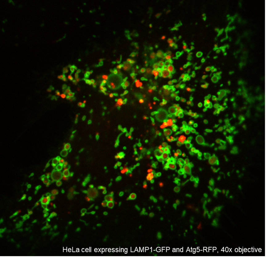 Are you interested in #mitochondria, #lysosomes, #peroxisomes? How defects in these organelles modify #metabolism and cause #disease?
We are *actively* looking for a colleague for a funded postdoc position based on multi-omics and imaging data.
DM for details, please retweet