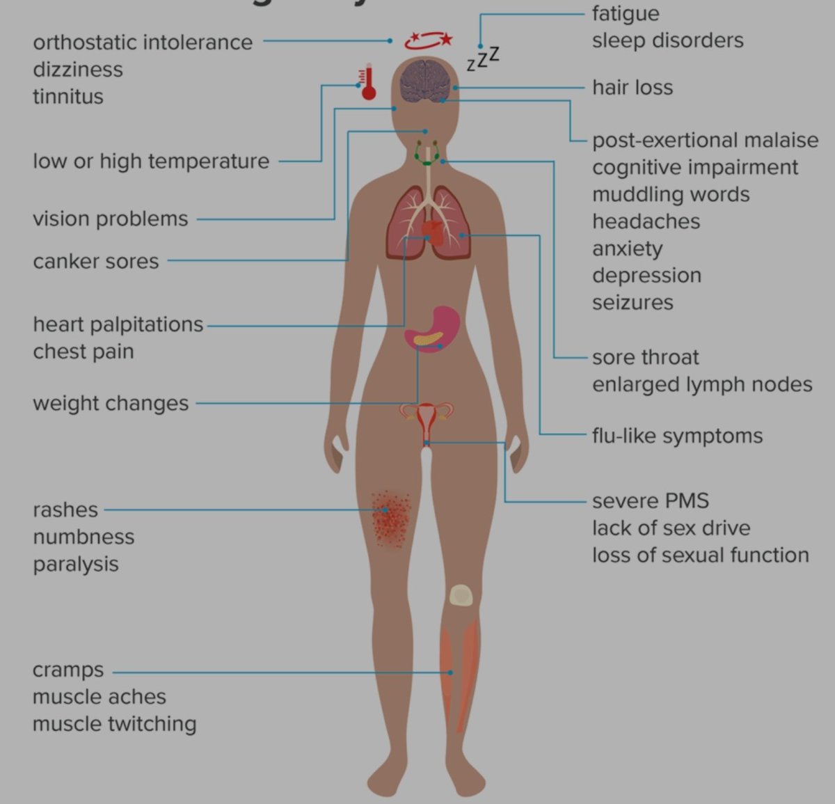 sarahhunter25's tweet photo. There is more to #MyalgicEncephalomyelitis than fatigue , for some reason when sufferers say we have M.E we get "oh that illness that makes you feel tired" NO. M.E has more symptoms than fatigue. Take a look and see what M.E does to the body. https://t.co/zSinLjyK6r