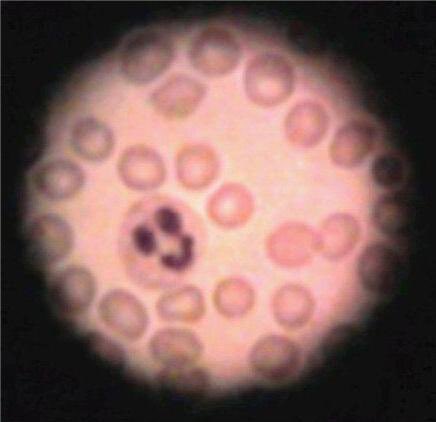 I've probably taken 100s of images under the microscope. This was the first ever, during my undergraduate degree when I had my first ever morphology lesson. 

#NeutrophilsAreAMood #tb