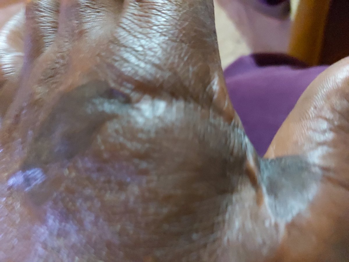 timothynjoya's tweet image. Today is 45th anniversary since labour day 1977 when under the Kenyatta regime 9 policemen visited  my house, chopped off my three fingers, injured my whole body and left me for dead. That morning I had preached that Harambee is the Ideology of the Kikuyu middleclass.