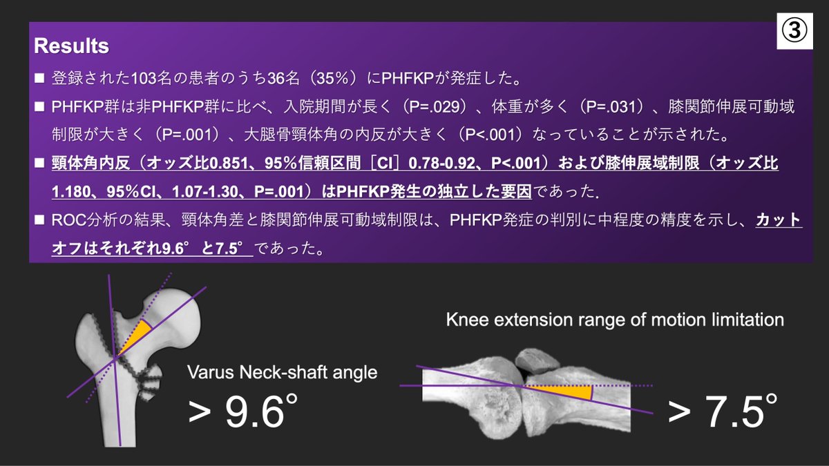 copellist's tweet image. 大腿骨近位部骨折後に膝関節疼痛(PHFKP)を発生する患者さん、いませんか？
PHFKP発症の予測因子とカットオフ値を明らかにした論文がPM&amp;amp;R Journalにて公開されました✨
カットオフ値は、簡便に計測でき、有用と思われます😊
是非ご一読ください🌸
🔗 doi.org/10.1002/pmrj.1…
#拡散希望 🙇 #PMRJournal