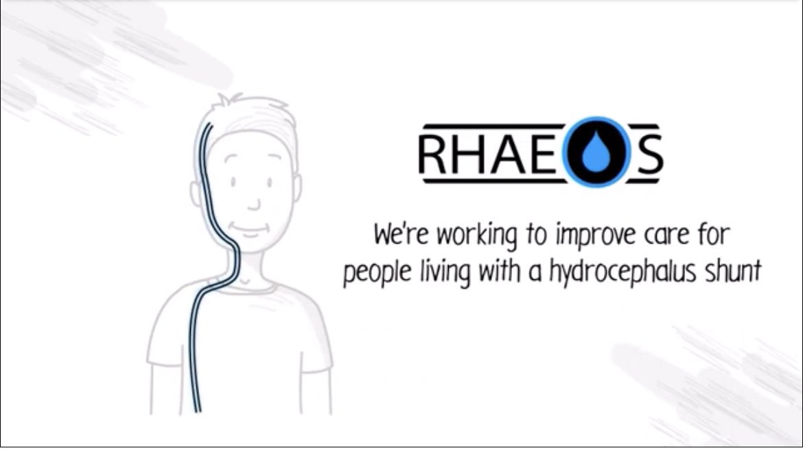 rhaeos's tweet photo. Learn more about the #FlowSense clinical study for #hydrocephalus patients here https://t.co/0tG6b22vDU. #noninvasive #wearable #neurosurgery https://t.co/rBCfYG9Iae