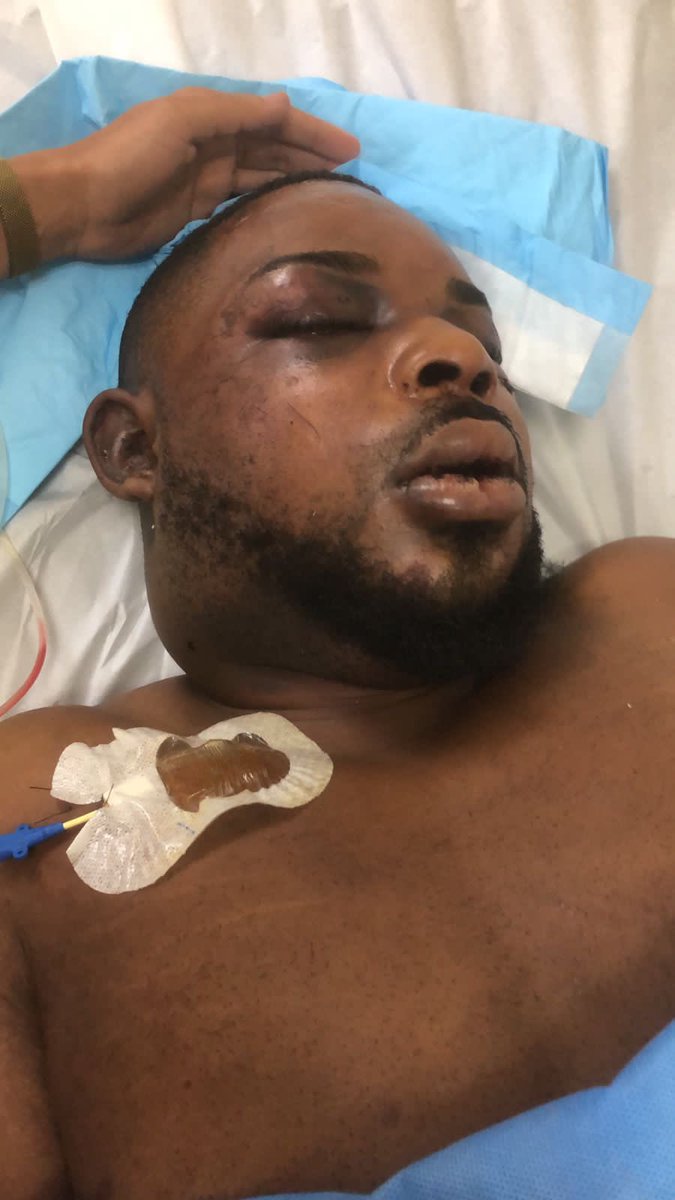 patriaurbaez's tweet photo. Estas imágenes llegaron a mi para que hiciera Eco del caso de #DaviddelosSantos Así lo encontraron los familiares en el Moscoso Puello bajo la custodia de La Policía, según contó la familia. A ellos les dijeron que los golpes se los hizo él y que por eso lo mandaron al médico. https://t.co/fl8CLAQSP4