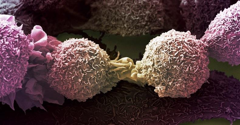 CaraSantaMaria's tweet photo. A new study offers a possible answer to the question, “Why me?” when it comes to cancer. 

#Cancer #CellMutation #BadLuck #CancerCause #EnvironmentalFactors 

https://t.co/I3HIV3jYJg via @sciam https://t.co/Wq0dmghRzS