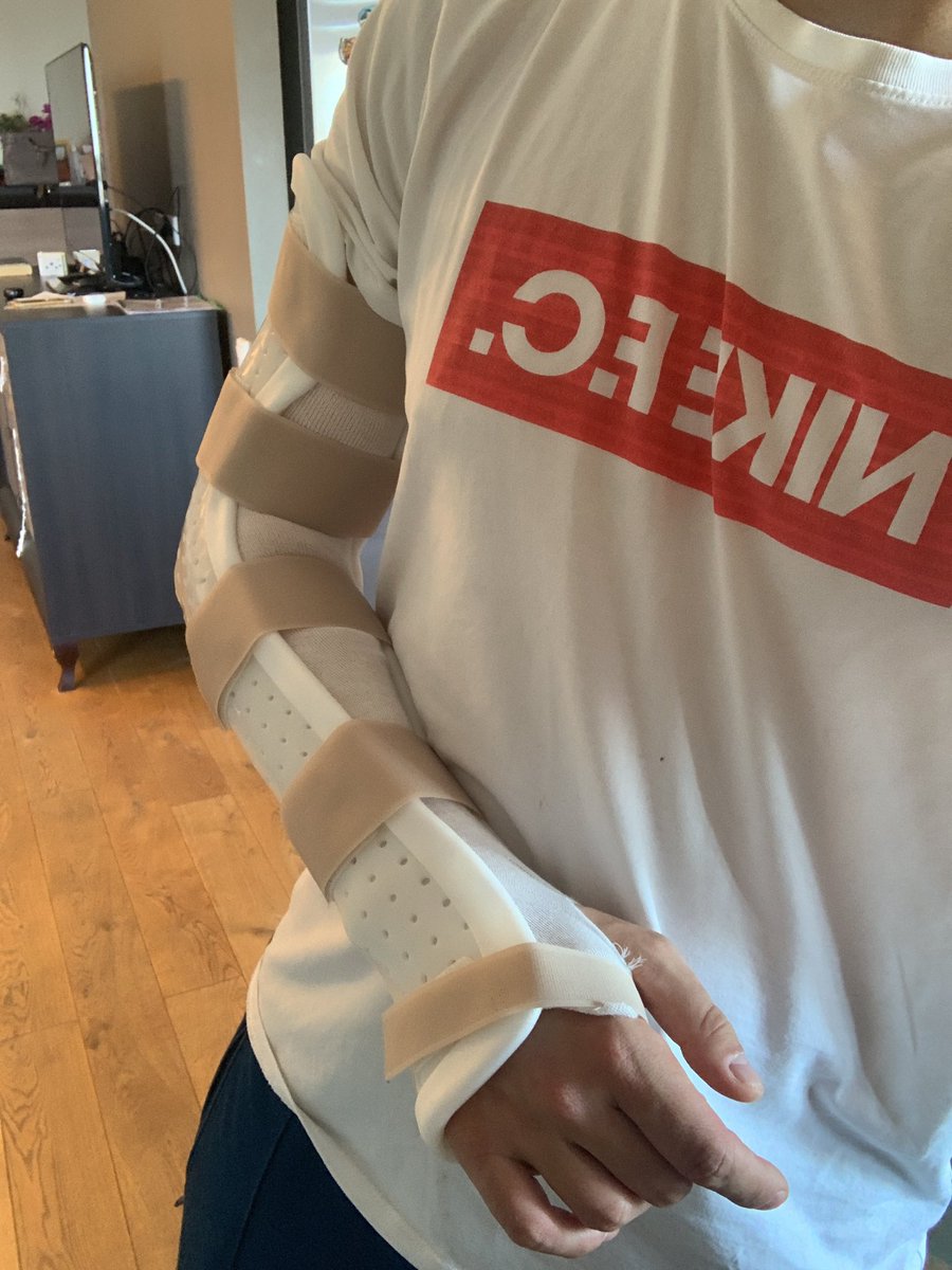 TemSimenko's tweet photo. Party disabled for 6 weeks. Crashed while road cycling - holded on handlebar and wanted to put the phone into the pocket. If didn’t wear helmet - definitely wouldn’t be able to post this. So take care, #helmetsaveslife https://t.co/S1DfEWHGRO