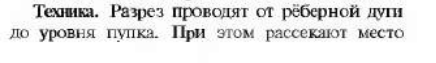 Waterydad's tweet photo. прочитала: "разрез проводят от гребанной дуги до уровня пупка". 

что было бы, если бы учебник писал маккой https://t.co/yYhIvY6kat