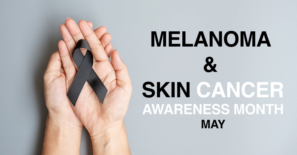Melanoma and other skin cancers can be prevented by avoiding too much exposure to Ultraviolet (UV) rays and protecting your skin from the sun through the use of sunscreens, hats, and sunglasses. Can melanoma be found early? Find out here bit.ly/3k94GUV  #MelanomaMonday