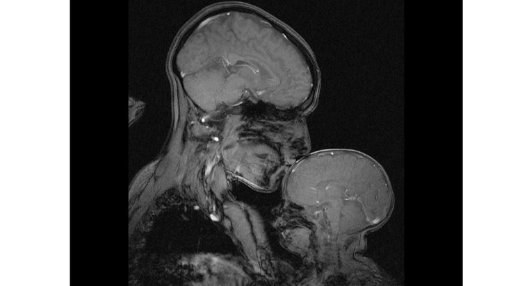 BLOC project (@blocprojecteu) on Twitter photo In May we celebrate #MothersDay2022 in about 130 countries. Nothing better to mark the date than this warm #NMR image from the <a href="/MIT/">Massachusetts Institute of Technology (MIT)</a> neuroscientist <a href="/rebecca_saxe/">Rebecca Saxe</a> capturing the moment she kisses her baby. #MRI #WomenInSTEM #research #Bioengineering In May we celebrate #MothersDay2022 in about 130 countries. Nothing better to mark the date than this warm #NMR image from the <a href="/MIT/">Massachusetts Institute of Technology (MIT)</a> neuroscientist <a href="/rebecca_saxe/">Rebecca Saxe</a> capturing the moment she kisses her baby. #MRI #WomenInSTEM #research #Bioengineering