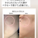 ツイートに含まれる画像