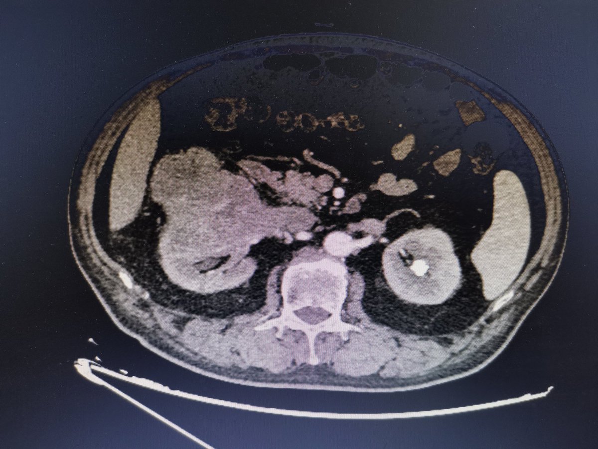 Yanbo Wang tweet media