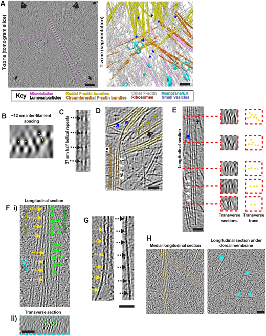 J_Cell_Sci's tweet photo. The article by Atherton @JoeAthertonKCL, Moores  @CarolynMoores1 @BirkbeckUoL &amp;co @KclRandallMol @KingsCollegeLon visualising the cytoskeletal machinery in neuronal growth cones using cryo-electron tomography is #openaccess: https://t.co/GIZRSfPHYI https://t.co/zVWTcPwQpK