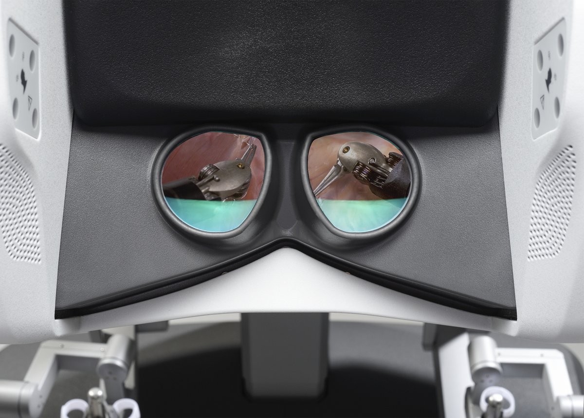 Together, your da Vinci surgeon console and endoscope optics deliver an immersive surgical experience. With highly magnified 3DHD vision and true depth perception, you can see tissue planes clearly, identify structures, and stay oriented in the anatomy.  go.intuitive.com/3vY4Lz7