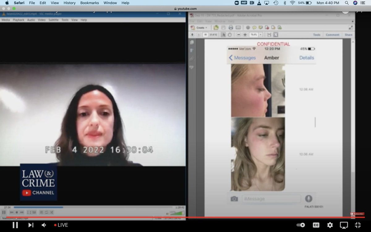 Angenette5's tweet photo. @LawCrimeNetwork Falati said she received this photo from #AmberHeard that shows a red mark on her face. Falati said she is not on expert but there is reddening. Several pics sent. #JohnnyDepp @LawCrimeNetwork https://t.co/pls9NXRsdU