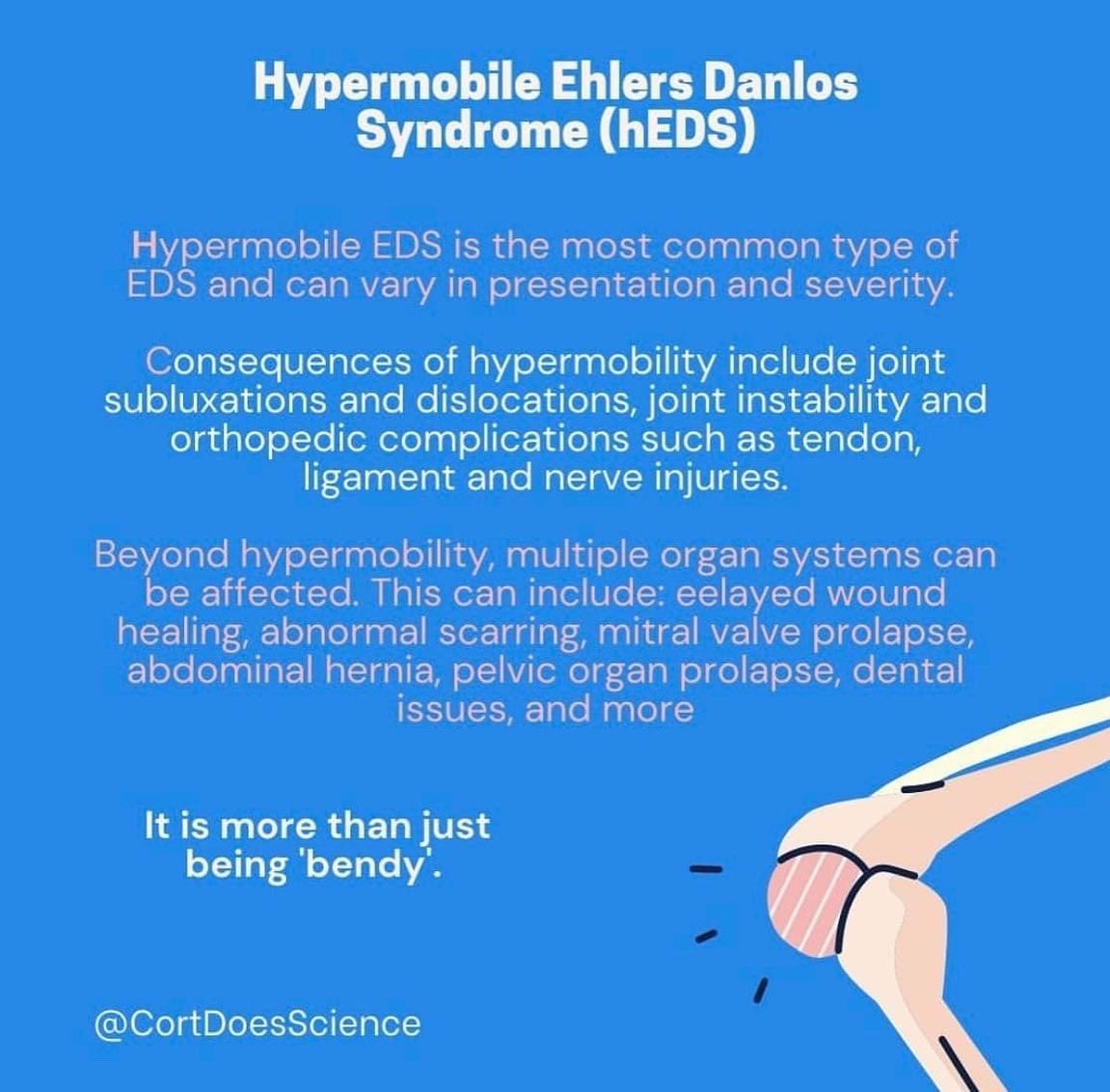 EileenClynes's tweet photo. May is Ehlers-Danlos Syndrome awareness month. I’ll be posting information on the syndrome along with my journey and my treatments so far. 💗 🦓 #edsawarenessmonth #ehlersdanlossyndrome #edszebra #eds #potssyndrome #mcas https://t.co/e5BCQyipRs