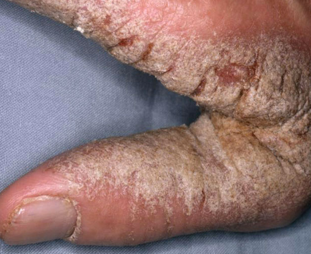 University of Missouri Infectious Diseases tweet media