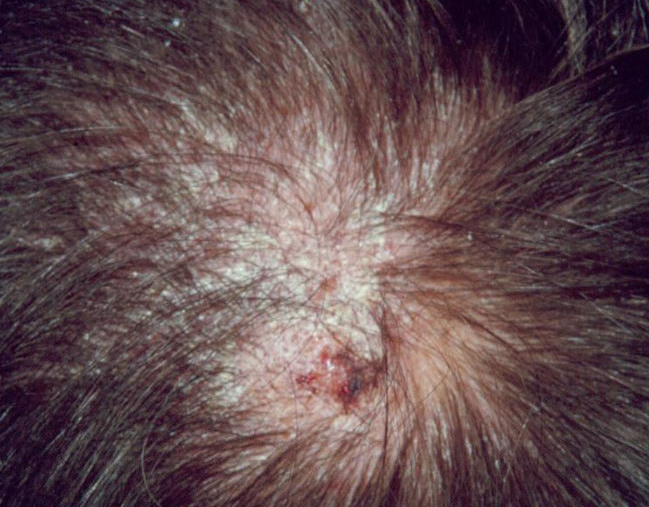 University of Missouri Infectious Diseases tweet media