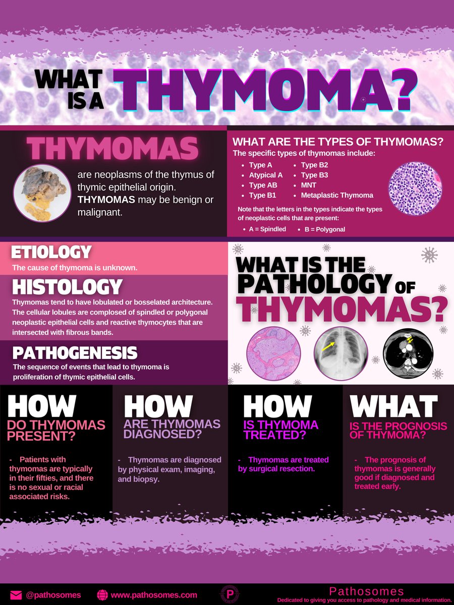 pathosomes's tweet photo. What are thymomas?

https://t.co/DldgVNdJ3S

#cancer #meded #research #science #health #healthcare #pathosomes #twitterpath #MedStudentTwitter #medtwitter #PathMatch2023 #FOAMed #hemepath #Match2023 #path2path https://t.co/sJsJ3GIe5i