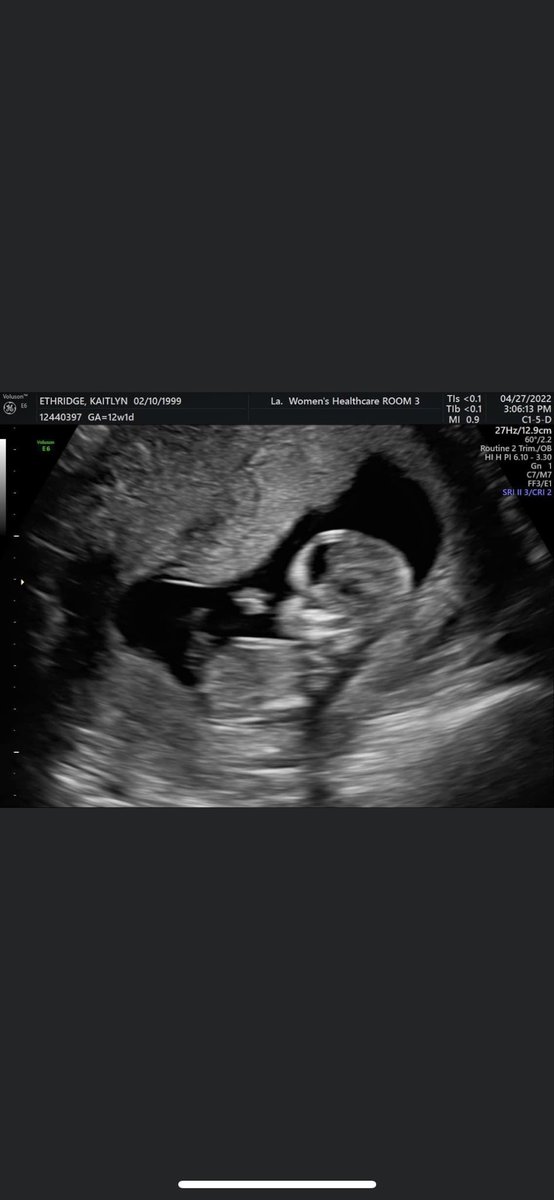 CasenMaggio's tweet photo. Beyond excited for this next adventure 🥺❤️ https://t.co/bVT6djLMqm