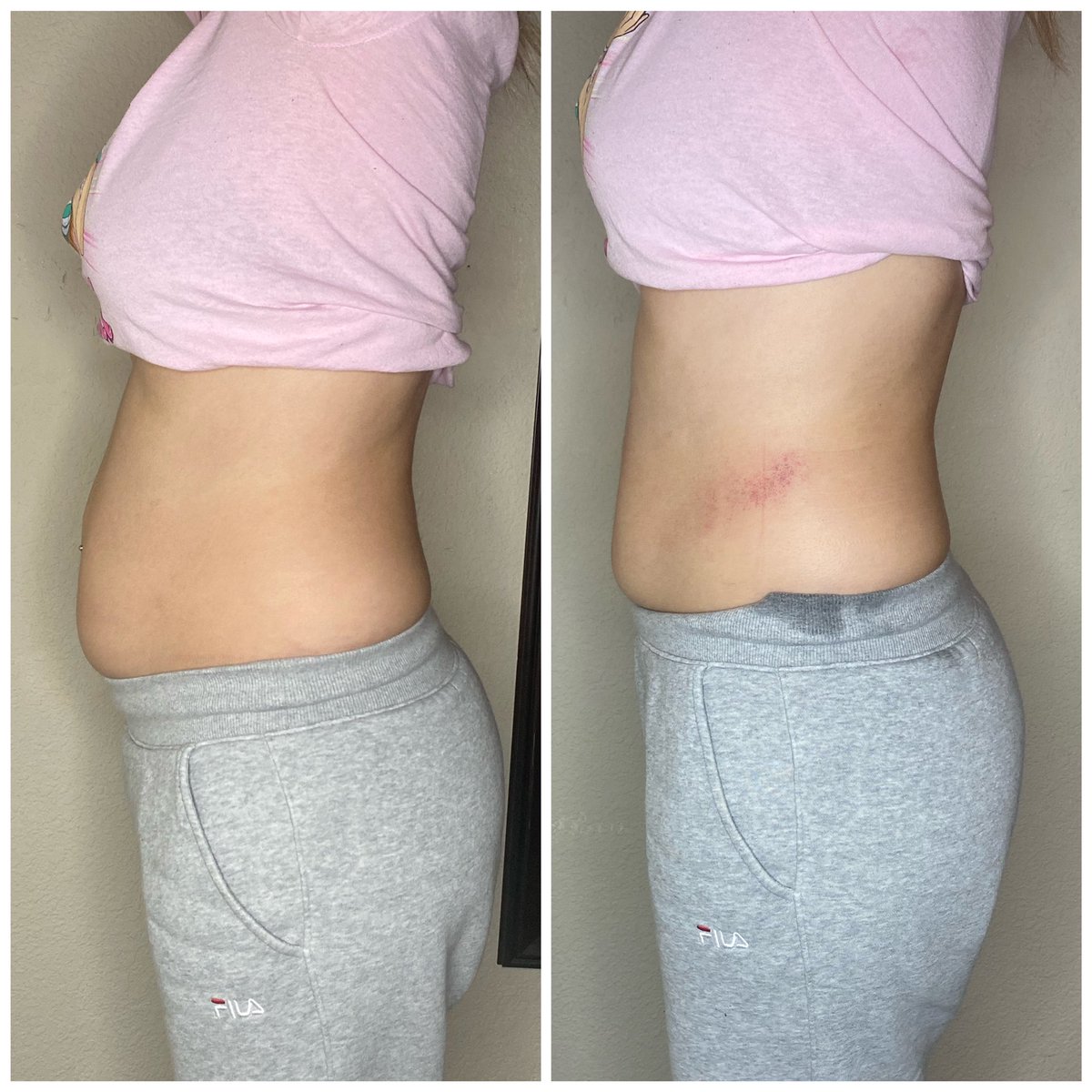 __andrreaaa's tweet photo. A simple rt/like can help my small business grow 🥺💗 @as_beautybodies https://t.co/KbNpJ2Vypa