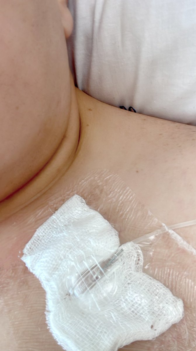 Aquí casual en mi última semana de quimio 💪🏻❤️ y el domingo mi cumpleaños quiero celebrarlo aquí! Celebrar la vida carajo!