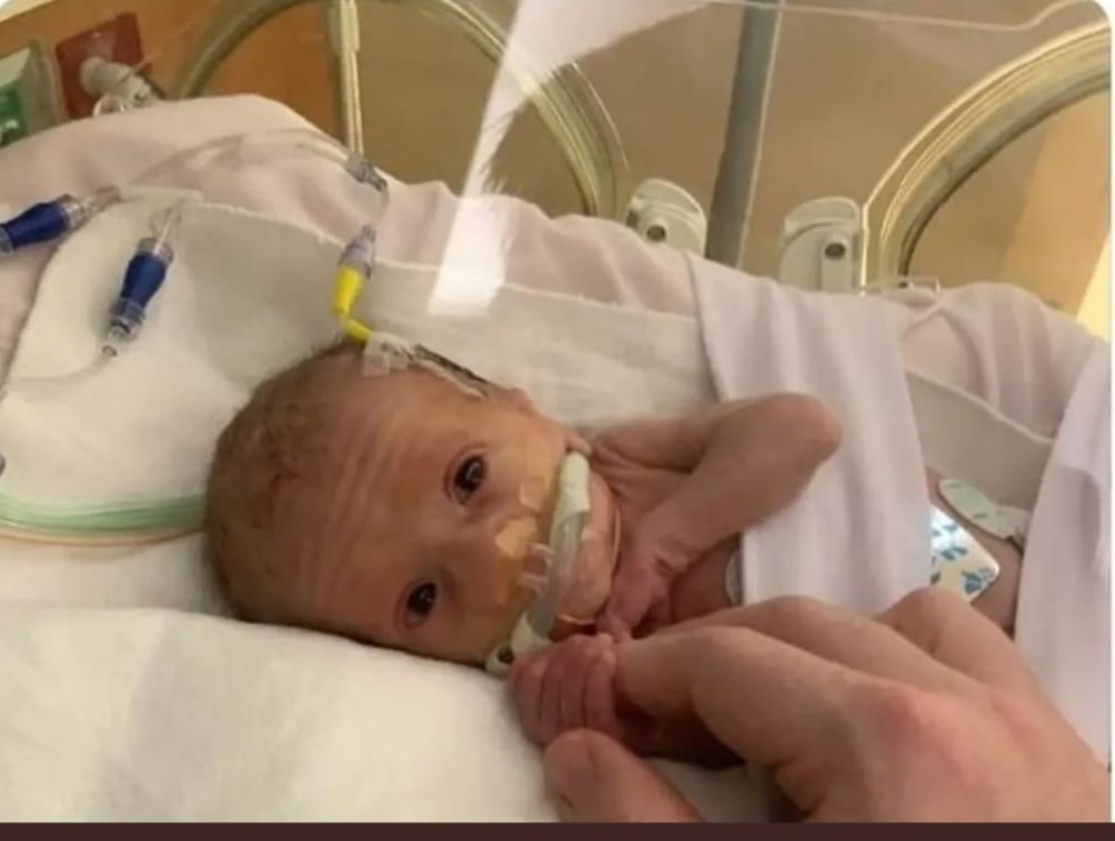 Maria_EstevezG's tweet photo. 🙏 En la foto podemos ver un bebé de 6 meses, desde hoy la ley permite matarlos.

👉Los mellizos de la #Ministra de Igual_da, tenían 6 meses cuando nacieron.

😢No deis me gusta, retwittear para que todo el mundo se entere

@VoxNavarra #ChicasVox52 #SiAlaVida https://t.co/RAQGK8K4kD