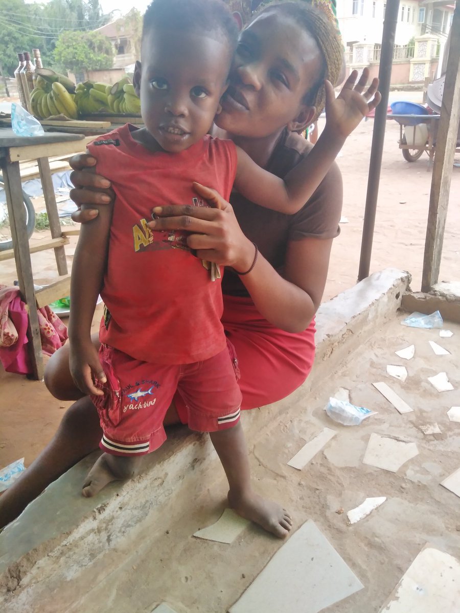 DfdpFoundation's tweet photo. We are seeking for opportunities of improving the life of this innocent child and we are giving counselling / inspirations that will encourage the mother and ensure that the baby is not used as object of charity.
#helpustouchhislife
#childrenwithdisabilities
#Everychildmatters https://t.co/fp85QPrfXP