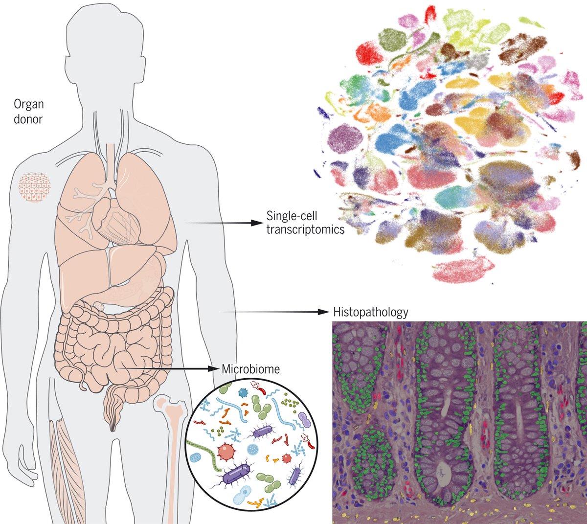 ScienceMagazine's tweet photo. In a new study, researchers with the #HumanCellAtlas consortium present the #TabulaSapiens dataset, a particularly broad cell atlas that provides a molecular definition of more than 400 cell types across 24 organs. https://t.co/9Uv2TGvUcY https://t.co/GL9jW6nP5J