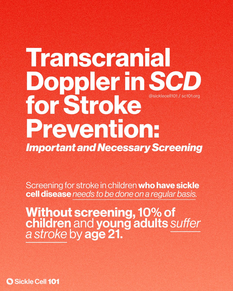 sicklecell101's tweet image. Did you know by the age of 40 years 20% of people who have #sicklecell anemia (SS) have suffered a stroke &amp;amp; 10% of those w/ Hb SC disease have had a stroke?

May is Stroke Awareness Month. Learn more about strokes in sickle cell disease at sc101.org/sicklepedia/st…

#sicklecell101
