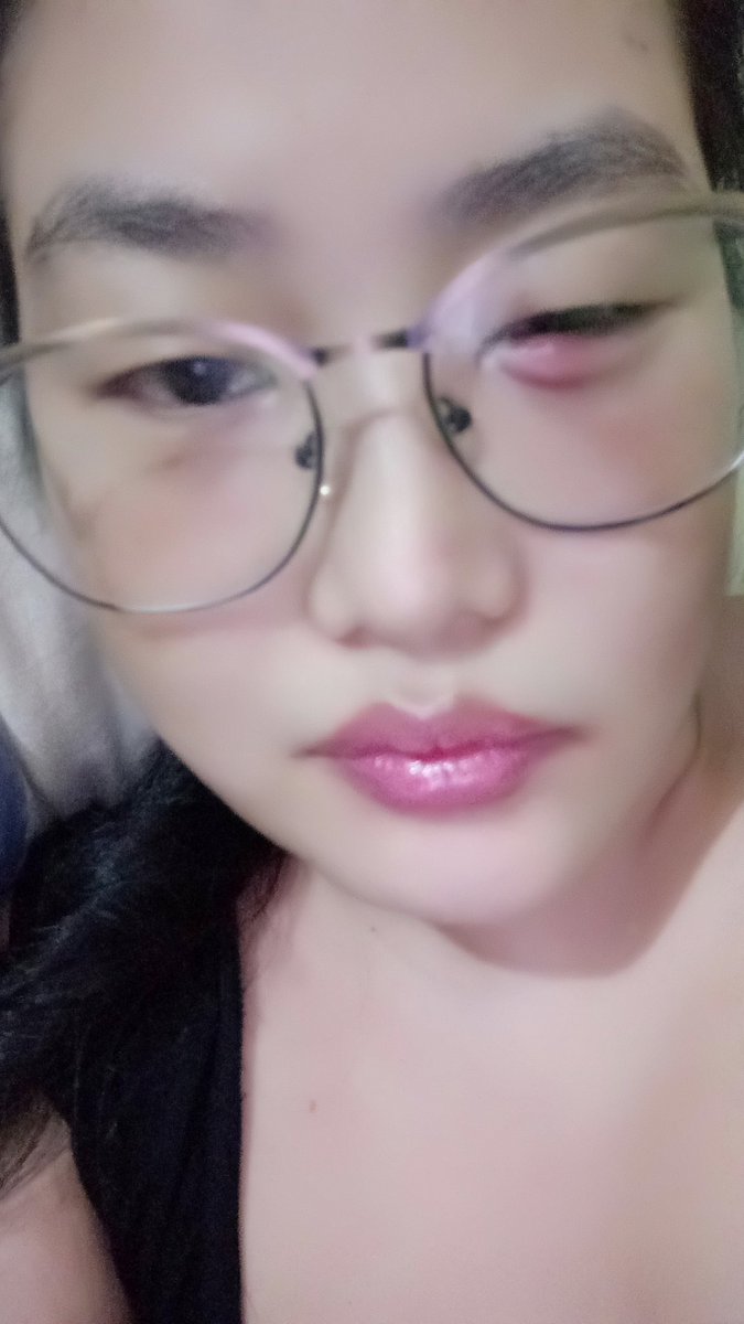 AngkangSarah's tweet photo. #thishurtsthemost 
#eyesproblem 
Because If This I Can't See Properly 
😔😥 https://t.co/3Frt58WR3m