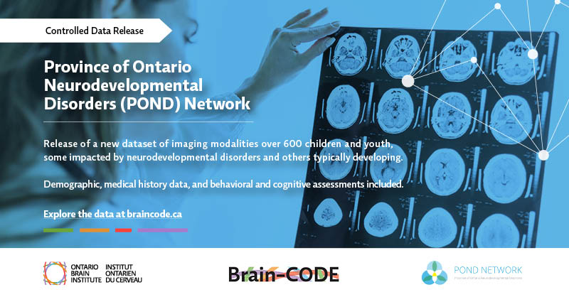 OntarioBrain's tweet photo. Attention researchers & clinicians! Access a new #dataset of #pediatric #imagingmodalities from @PONDNetwork to further accelerate your investigation into #neurodevelopmentaldisorders. Explore this #openaccess #clinicaldata at https://t.co/rcw6kKbYER.
#datarelease #brainhealth https://t.co/hYswsyQF9v