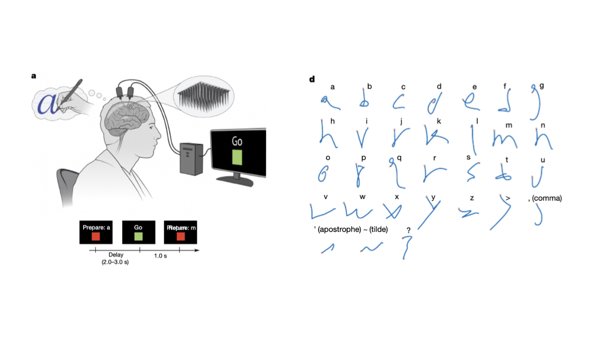 fermatslibrary's tweet photo. This week's paper is "High-performance brain-to-text communication via handwriting" by Francis R. Willett et al: "The participant, whose hand was paralysed from spinal cord injury, achieved typing speeds of 90 characters per min with 94.1% accuracy"

📝 https://t.co/Tp8W8fVsPC https://t.co/5RHPudOh5N