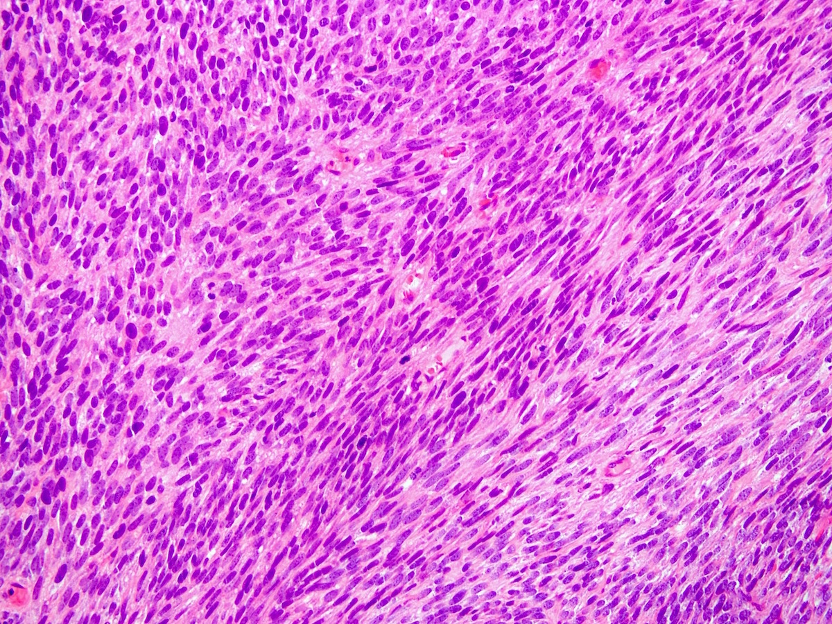 sofpromed tweet picture