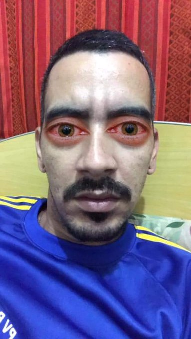 fumeimuito's tweet photo. Minha mãe: você só me dá desgosto

Eu: quem caiu no esgoto ? https://t.co/DonKJwO3yO
