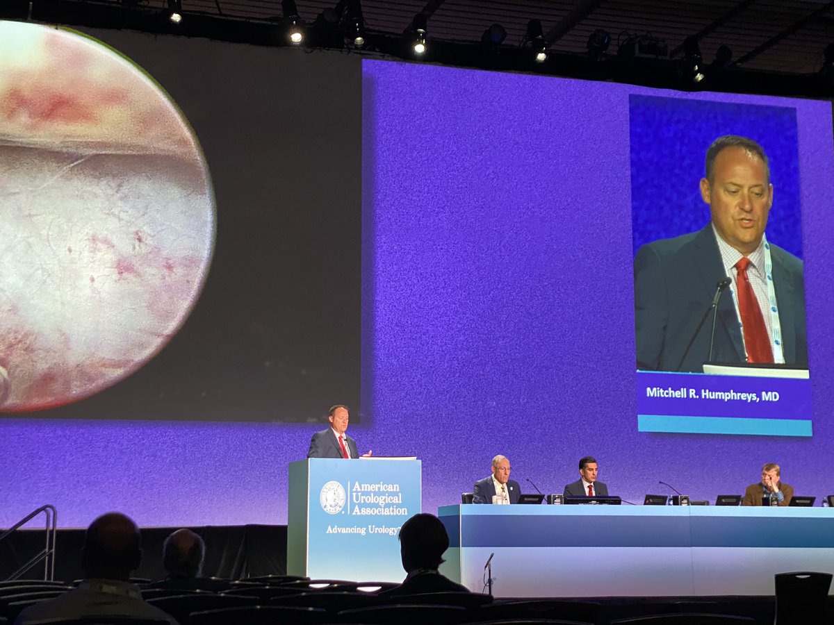 RRGonzalezMD's tweet photo. Semi Live BPH therapies at plenary #AUA22 highlighting @iTind_System @ChughtaiMD 
#HoLEP @MayoMitch and advancements with #urolift (how to manage median lobe) @greggeure 
The BPH renaissance continues @Dr_KevinZorn @MaleHealthDoc https://t.co/hhotBSyNoE