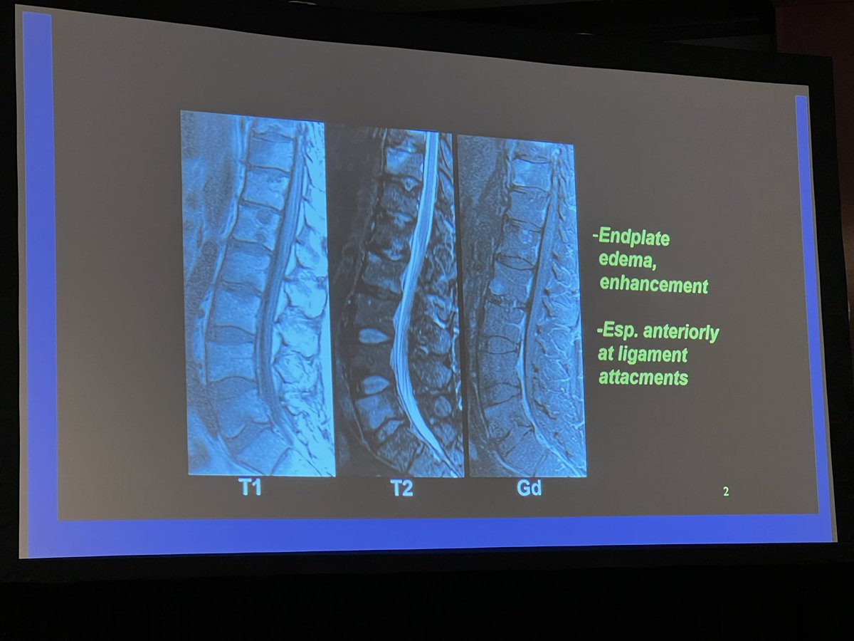 The_ASSR's tweet photo. Imaging findings of SpA from Dr. John Carrino 

#SNRXXII #ASNR22 @JackASSR23 @LubdhaShah @KSeifertMD @radiology_ninja @OrmsbyMD https://t.co/8OawVAkbbn