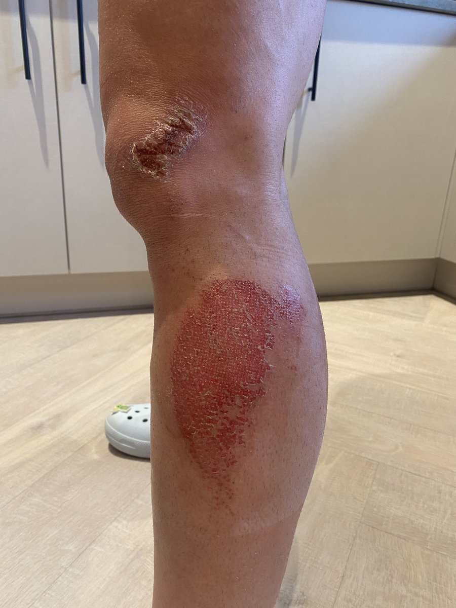 Dan Robson tweet media