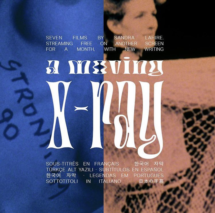 zoeleska_'s tweet photo. Tá no ar o novo programa da @anothergaze,“A Moving X-Ray - Sete filmes de Sandra Lahire”,no https://t.co/UASiuanAFQ. Com traduções em português feitas por mim, Marcela Lanius &amp; Emanuela Siqueira/ @notasaleatorias.
https://t.co/ihJ6YVwuqI https://t.co/fMrXAK6JRD