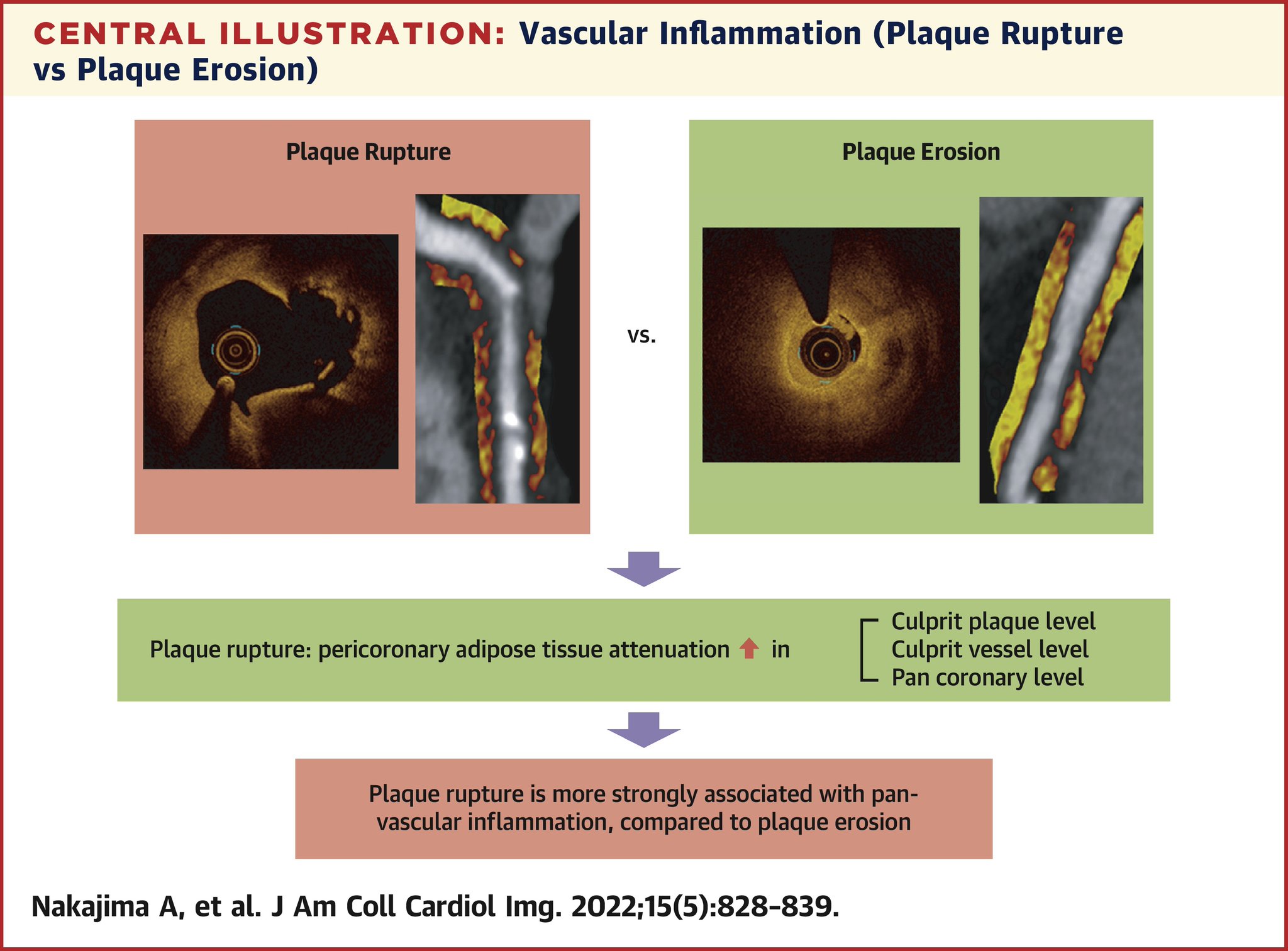 JACC Journals on Twitter "Understanding plaque rupture vs plaque