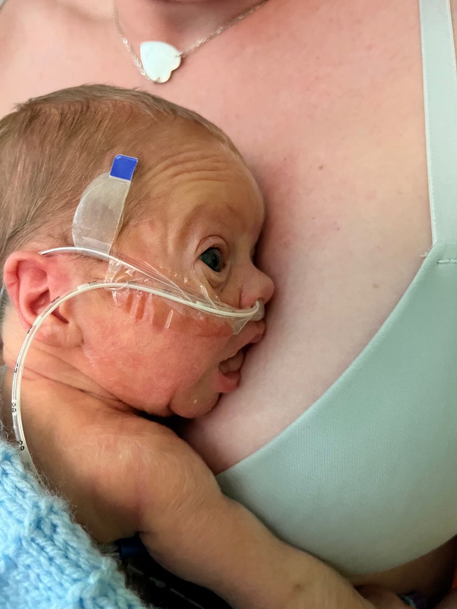 Bright Stars FIC Group in Neonatal unit kilmarnock tweet media