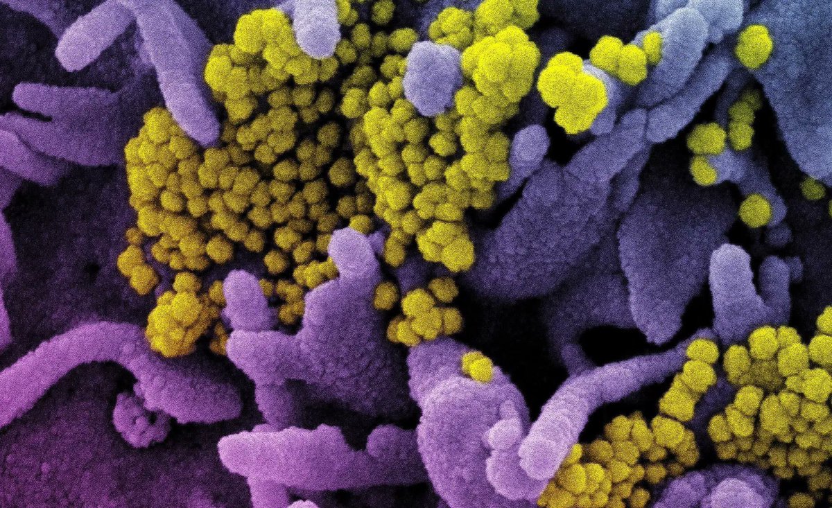 Thomas_Wilckens's tweet photo. SARS-CoV-2 #Omicron infection boosts #Delta immunity in those who have been vaccinated https://t.co/93mfLnckjL Does the study design & cohort of 39 (27 hospitalized) individuals justify the bold, generalized headline? #coronavirus #sciencedialogue #research @Nature https://t.co/sSSQdFgWGo