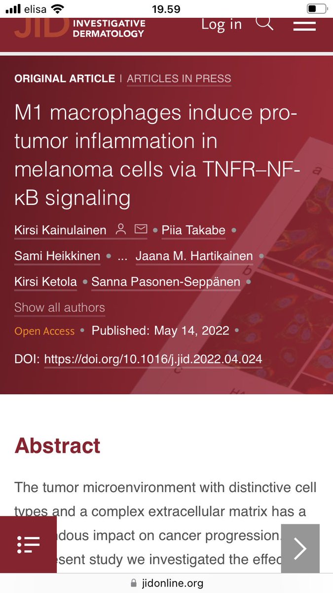 PasonenSanna's tweet photo. Finally, our paper is accepted and is now in press in J Invest Dermatol. A study about protumor effects of M1-macrophages in melanoma. After many years of hard work 🔬🧬🧫 Thanks to all coauthors @KirsiKainulain @kirsiketola et al and funders. @UEF_Biomed https://t.co/0wfZHgftQl