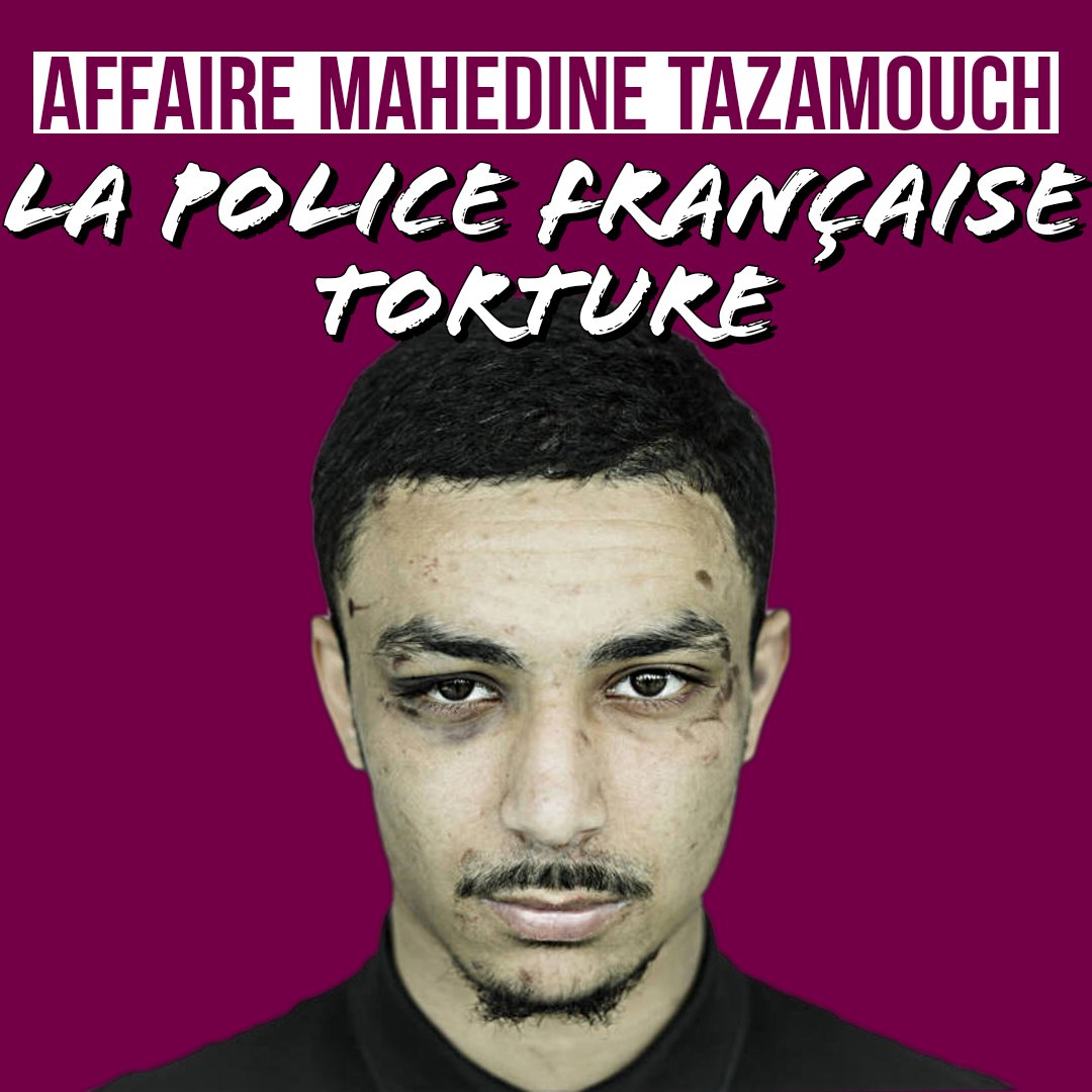 CerveauxNon's tweet photo. 🔴 LA POLICE TORTURE 🔴

Une nouvelle terrible histoire que l'IGPN va tenter d'étouffer. Libération rapporte le témoignage glaçant de Mahedine Tazamoucht. #violencespolicieres #tortures #juvisy 
#Thread https://t.co/ffvhoF9VmS