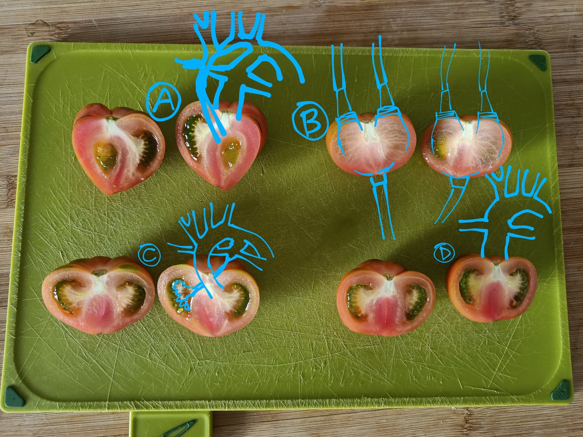 Just another day of COVID-19 quarantine facing ordinary clinical problems in the kitchen.
Which tomato will have the best outcome? <a href="/sgcard/">Sunil Ghelani</a> <a href="/NicMaschietto/">Nicola Maschietto</a> <a href="/GEgidyAssenza/">Gabriele Egidy Assenza</a> <a href="/sasha_opo/">Alexander (Sasha) Opotowsky</a> <a href="/mariuccielisab/">Elisabetta Mariucci</a> <a href="/valeriaduarteMD/">Valeria Duarte MD MPH</a>